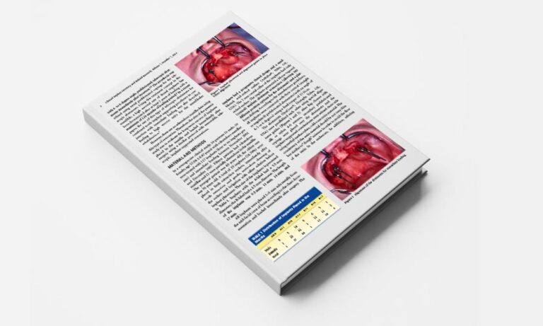 Implant Supporting Telescopic Maxillary Prostheses and Immediate Loading