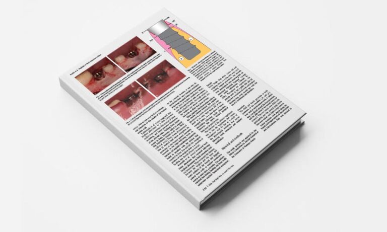 Tissue modeling following implant placement in fresh extraction sockets