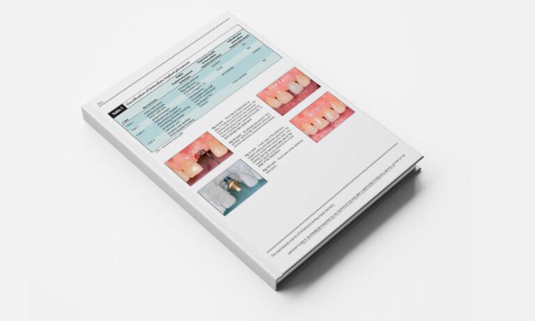 Timing, Positioning, and Sequential Staging in Esthetic Implant Therapy A Four-Dimensional Perspective