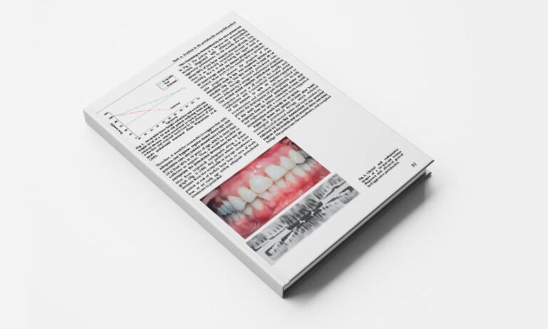 Hierarchical decisions on teeth vs. implants in the periodontitis- susceptible patient: the modern dilemma