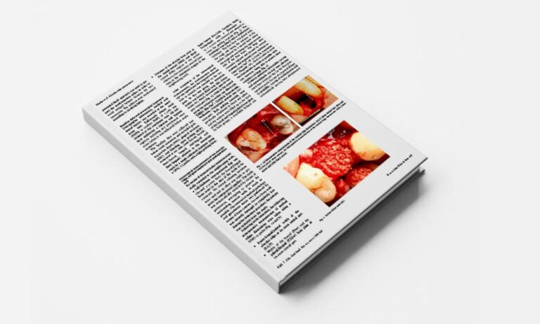 Alveolar ridge preservation with guided bone regeneration and a synthetic bone substitute or a bovine-derived xenograft: a randomized, controlled clinical trial