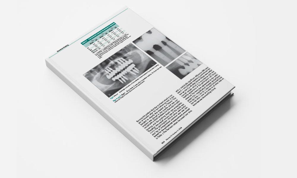 Immediate Loading Using Cross-Arch Fixed Restorations in Heavy Smokers