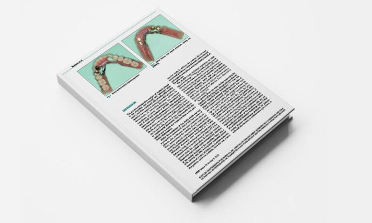 Immediate Loading of Tooth-Implant–Supported Telescopic Mandibular Prostheses