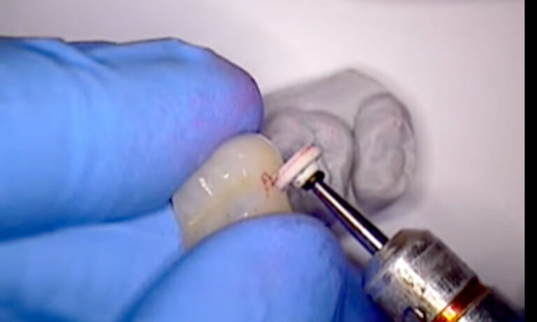 “Fit Check” all of your cases – Take charge of your quality control before you seat your case