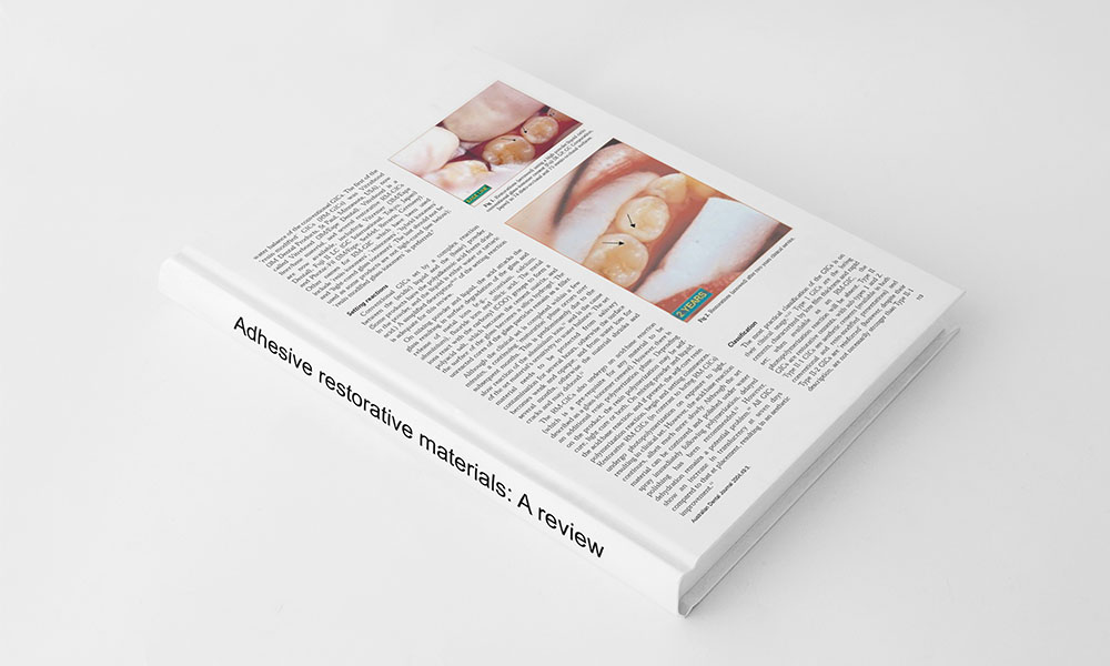 Adhesive restorative materials: A review