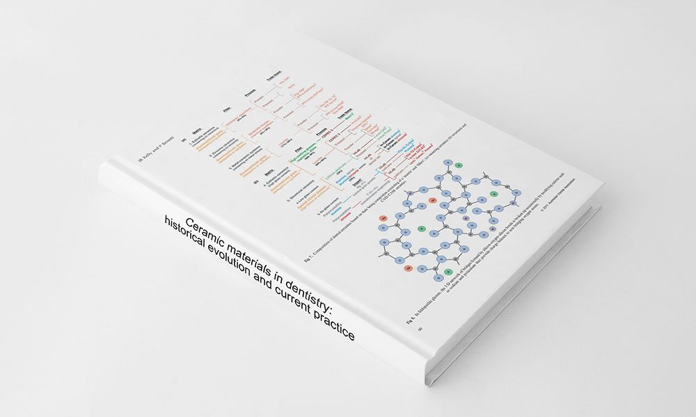 Ceramic Materials in Dentistry Historical Evolution and Current